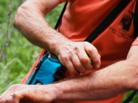 Mugwort juice for poison oak rash